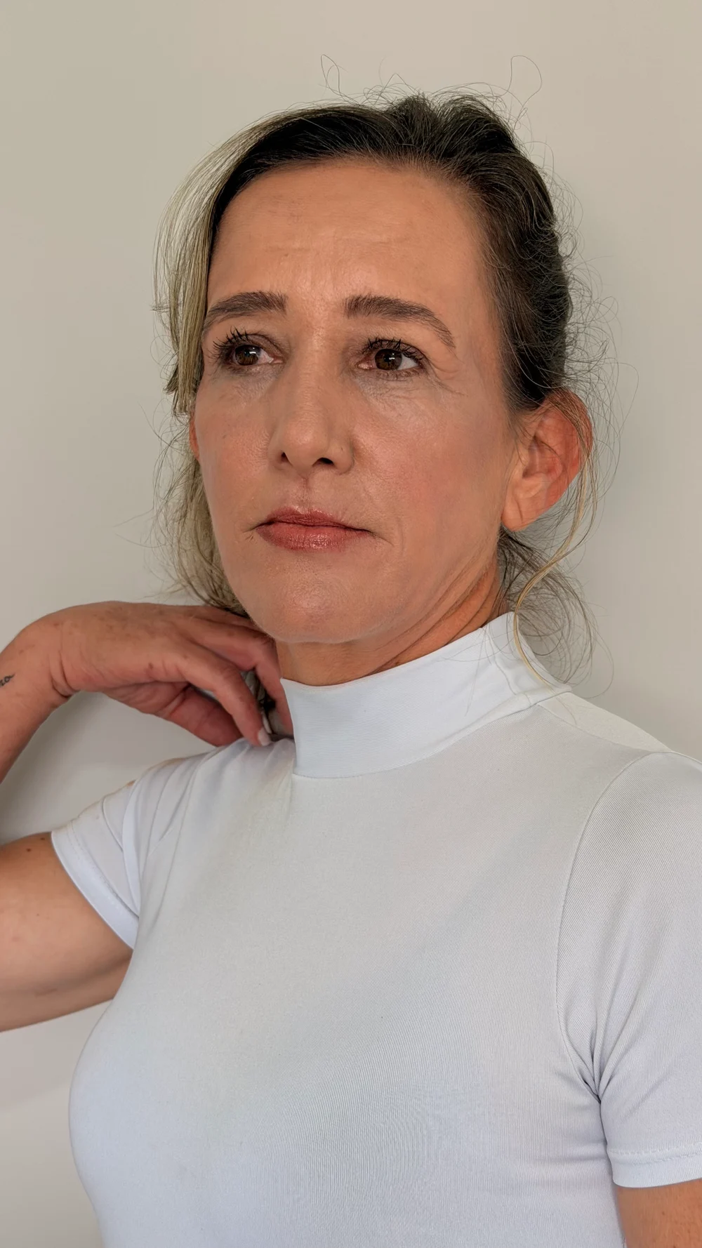Depois do tratamento de rejuvenescimento facial realizado por Camila Borges